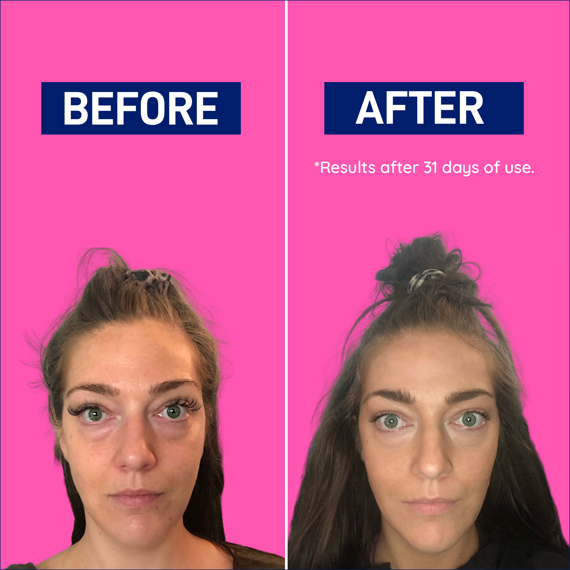 Before & after results tile for LEANFIT Hydrolyzed Collagen — visible improvement after consistent use (individual results may vary)