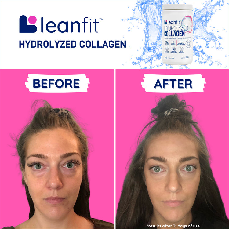 Before & after results for LEANFIT Hydrolyzed Collagen 1 kg — visible improvement after consistent use (results may vary)
