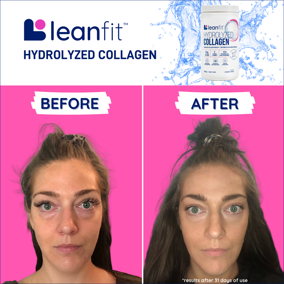 Before & after results for LEANFIT Hydrolyzed Collagen 1 kg — visible improvement after consistent use (results may vary)
